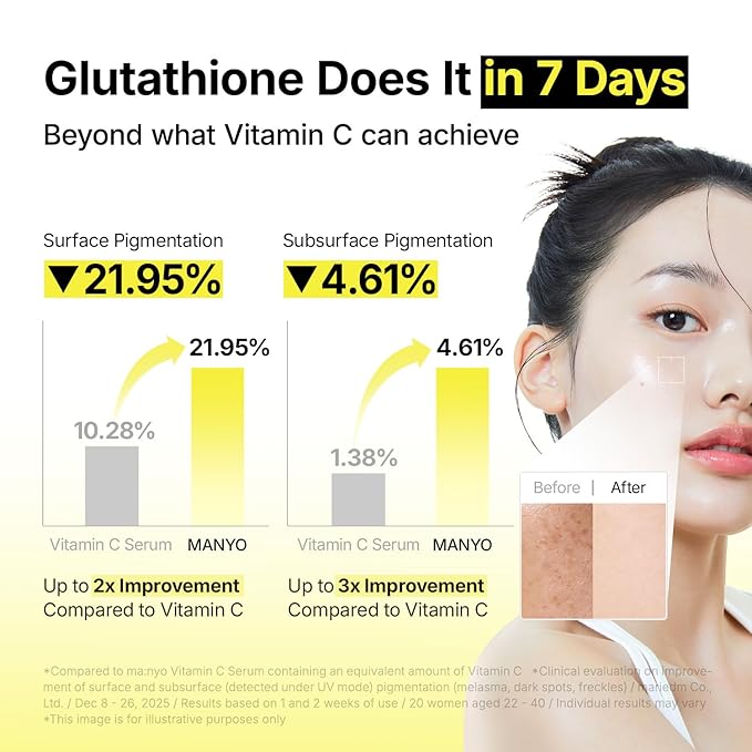 MANYO Glutathione 7 Dark Spot Serum, Niacinamide Serum for Uneven Skin Tone, Dark Spot Remover for Face & Radiance Booster, Korean Skincare, 1.01 fl.oz (30ml)
