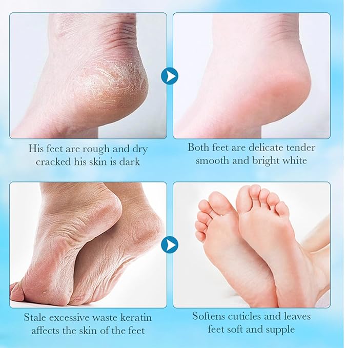 JoanofArc Foot Peeling Mask, Moisturizing Foot Mask,Peel Calluses Dead Skin Callus Remover,Hydrating Foot Masks for Dry Cracked Feet,Repair Rough Heels＆Dry Skin for Baby Soft and Smooth Feet,4 Pack