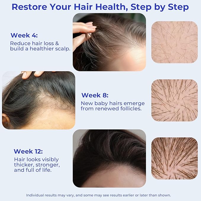 Rosemary Oil Hair Growth Serum Roll On – 3% Rosemary Oil, 2% Caffeine, 2% Niacinamide & DHT Blocking Complex, Non-Greasy Scalp Serum for Men & Women, Designed for Thinning, Fine & Weak Hair