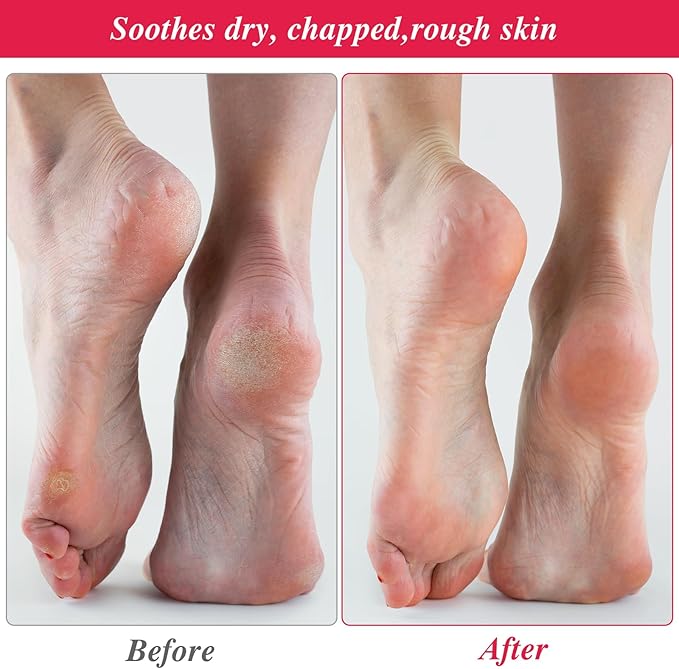 10-Pack White Spa Cotton Socks, Reusable Hydrating Socks, Cotton Blend Breathable Foot Mask Sleeves for Dry, Cracked Feet Relief, Overnight Moisturizing Foot Care, Home SPA Therapy
