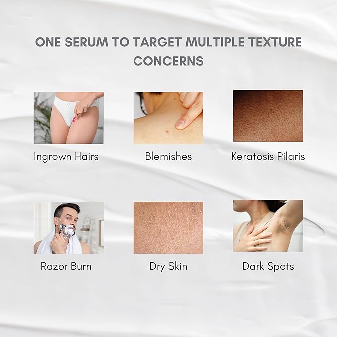 KP Treatment Serum - Triple Acid Complex (AHA + BHA + PHA) for Keratosis Pilaris | Gentle Daily Body Serum for Rough Bumpy Skin, Strawberry Legs & Ingrown Hairs | 4 fl oz
