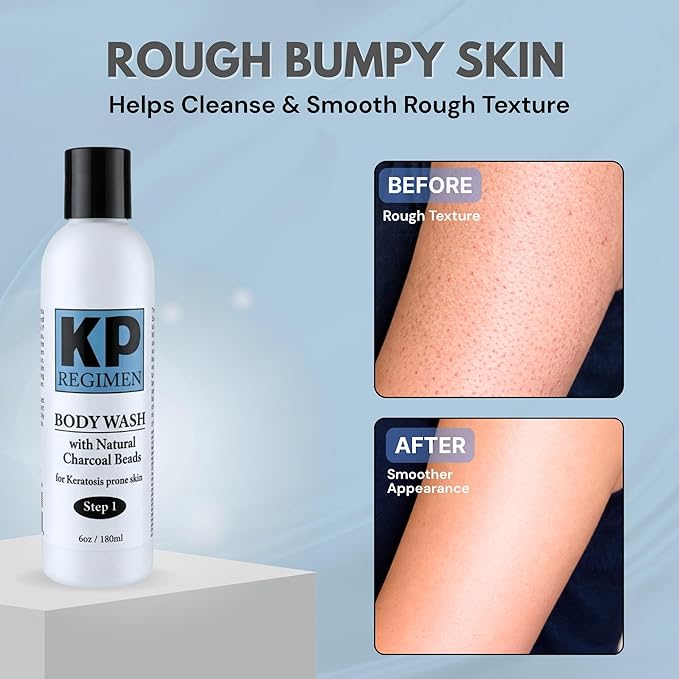 Keratosis Pilaris Exfoliating Face & Body Cleanser Wash with Natural Charcoal Beads Plus Essential Oils, Exfoliate Back & Butt skin bumps, Get Rid of Rough Skin & Red Bumps 6 oz