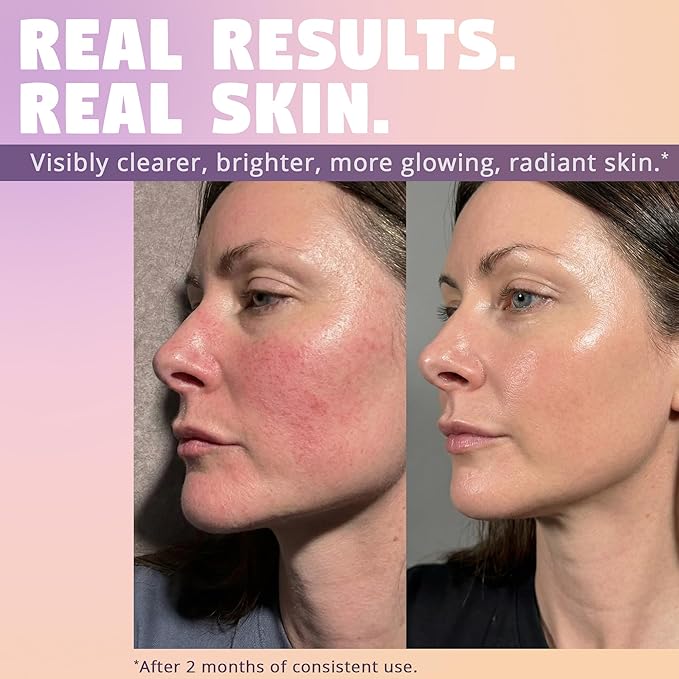 Violet Aura - 2% BHA Exfoliating Toner with Salicylic Acid for Sensitive Skin. Gentle, Hydrating Formula. 2% Niacinamide, Rice Extract & Azulene. Glass Skin, Smoother Texture & Barrier Support