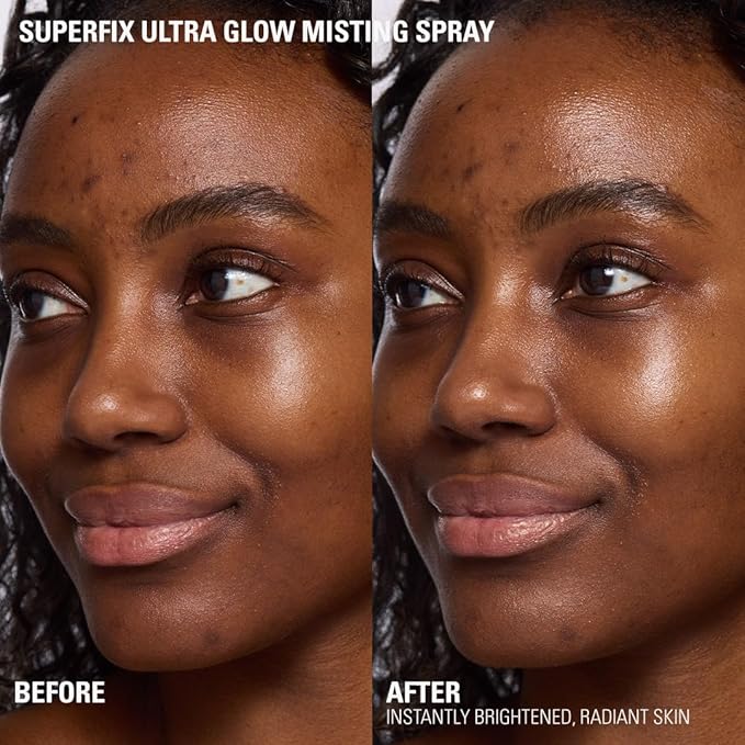 Revolution Beauty London, Superfix Glow Fixing Mist, Makeup Setting Spray with Shimmer Finish & Long Lasting-Hold, Vegan & Cruelty-Free, 5.07 fl oz