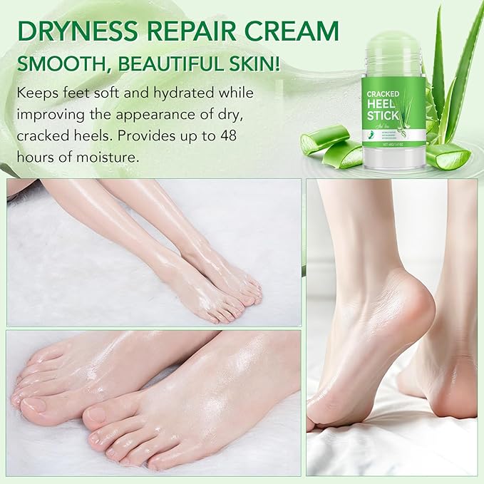 Cracked Heel Urea Stick,Aloe vera Scent,Foot Care Cream 60 Percent Stick,Maximum Strength Urea Cream for Feet,Moisturizer and Hydrates Dry Cracked Feet, Knees, Elbows, Hands