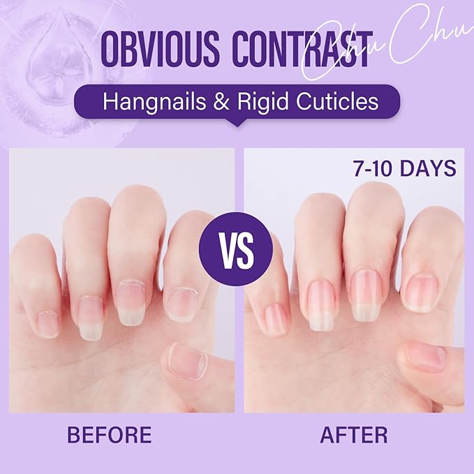 CHUCHU Vegan Cuticle Oil for Nails: Lavender Jojoba Nail Cuticle Oil with Vitamin B & E for Moisturizes Cuticle and Nail's Skin - Prevents Hangnails and Chapped 15ML