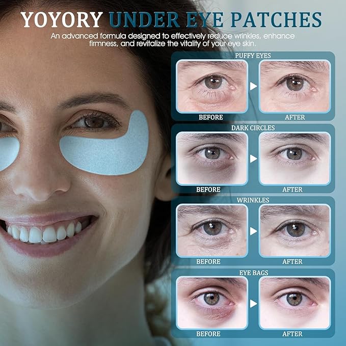 Under Eye Patches Masks - for Dark Circles,Puffy Eyes, Wrinkles, Eye Bags,Fine Lines,Treatment with Hyaluronic Acid and Collagen, Hydrating and Moisturizing (30 Pcs)