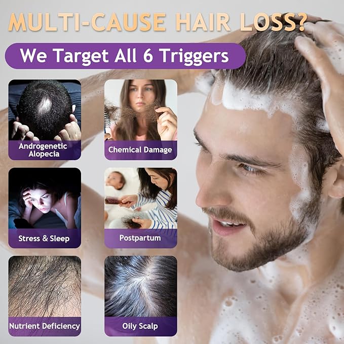 Biotin Hair Growth Shampoo, Hair Loss Shampoo for Thinning Hair for Women & Men, Strengthen Roots, Control Oil & Thicken Thin Hair, Sulfate-Free for All Hair Types, 10.1 Fl Oz-Fresh