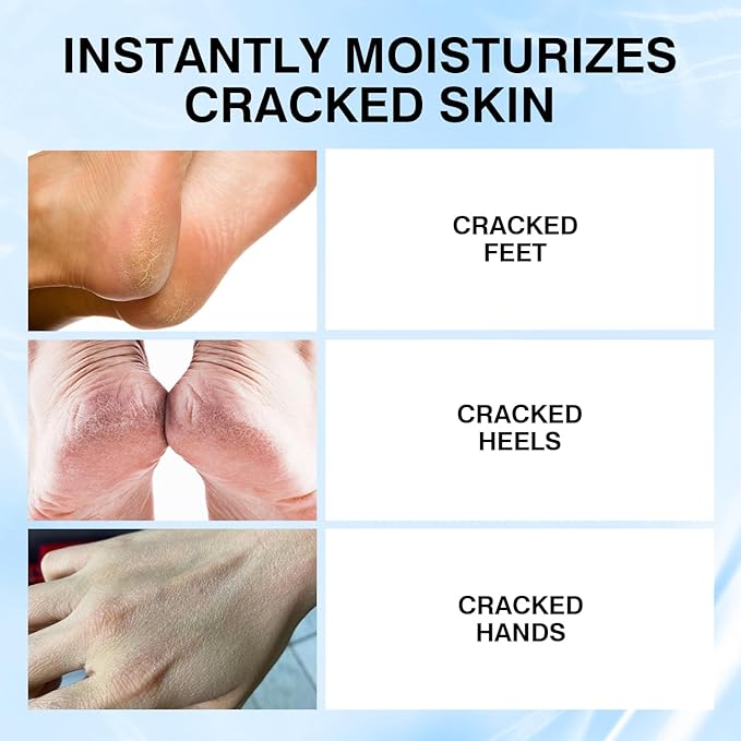 Professional Repair Heel Balm Stick -2 pcs, for dry cracked feet treatment, intensive foot repair, refreshingly smooth non-greasy texture