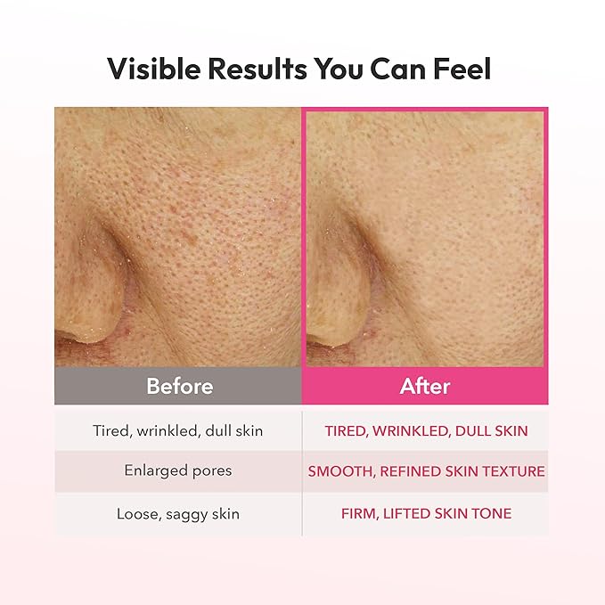 Avajar Red Collagen Hydrogel Mask, Face Mask with PDRN Intensely Hydrating Overnight Jelly Gel Mask with Rejubebe™ & Hyaluronic Acid for Pore Minimizing & Elasticity Korean Skin Care, 5 Pcs