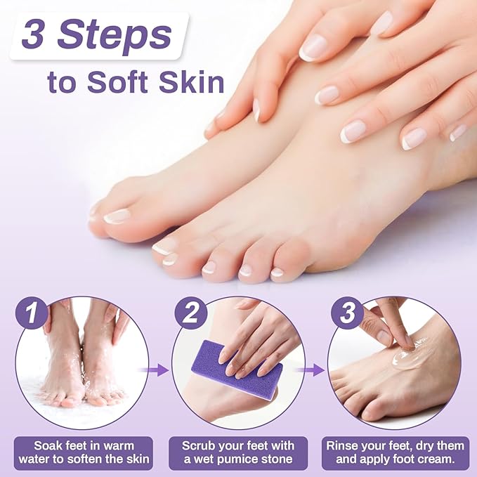 10 Pumice Stone for Feet - 4.7 x 2 x 1 Inch Double Side Purple Foot Pumice Stone, Foot Filer Pedicura Scrubber for Callus Removal, Foot Care Spa Productos for Dark Elbows Hard Skin Exfoliating
