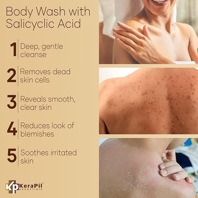 KERAPIL Exfoliating Body Wash with Salicylic Acid - No Dry Out, Gentle Exfoliates Rough and Bumpy Skin, Body Acne Wash, BHA & AHA - Coconut and Vanilla with Salicylic Acid - (16 fl oz)