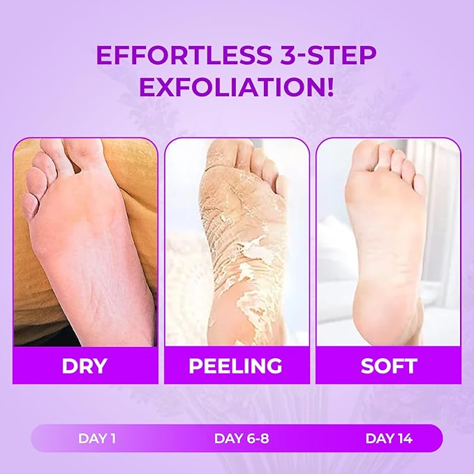 Happy Feet Foot Peel Mask, 03 Pack Original Exfoliant Foot Mask for Rough, Dry Skin | Gift for Mom Dad