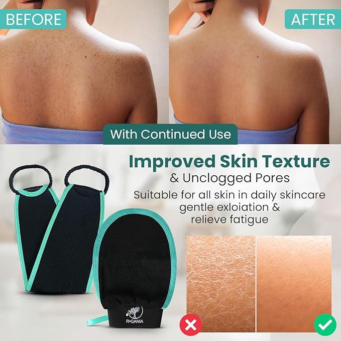 R'GANIA Deep Exfoliating Glove & Back Exfoliator – 100% Viscose. Korean Exfoliating Mitt for Removing Dead Skin, Keratosis Pilaris & Self-Tan – Full Body Exfoliator for Smooth, Glowing Skin