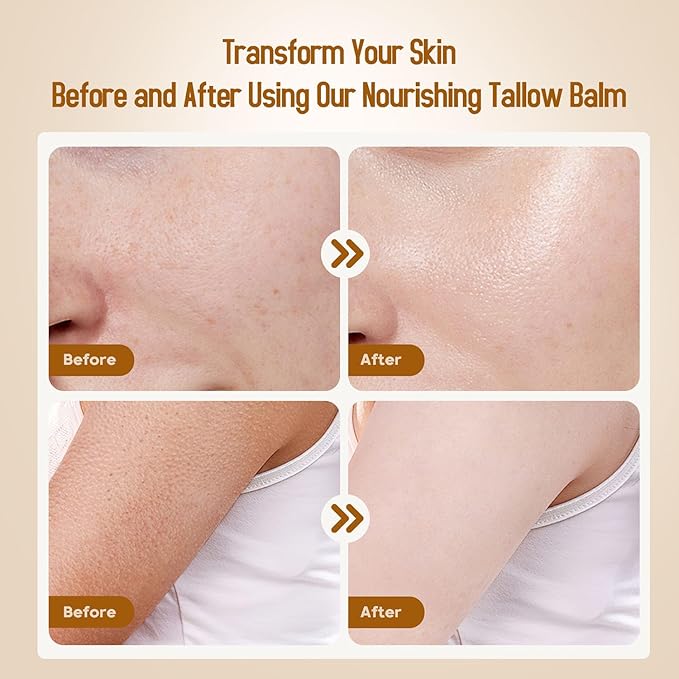 Hicream Beef Tallow for Skin, Beef Tallow and Honey Balm, 100% Organic Grass-Fed Beef Tallow, Face & Body Moisturizer for Dry, Cracked, Sensitive Skin - Handmade - Natural Formula (4 Oz, Unscented)