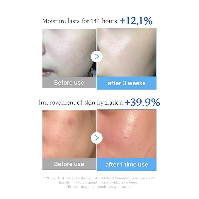 medicube Hyaluronic Moisture Boosting Duo: Hyaluronic Acid Capsule Cream and Hyaluronic Serum Set | Deep Hydration, Moisture Lock, and Plumping Care for Smooth, Healthy, and Dewy Skin