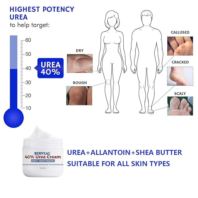 Urea Cream foot cream, 40 percent Foot Care Lotion for Cracked Heels,Moisturizing，Cracked Heels, Ultra,Rough, Dry, Calloused Feet,Softening Rough skin on feet for All Skin 5.29 fl.oz