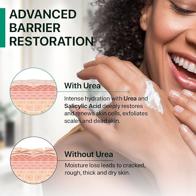 Urea Cream 40 Percent with Salicylic Acid 2% - Maximum Strength Callus Softener - Advanced Hand & Foot Moisturizer for Dry Cracked Heels, Knees, Elbows, Corns & Thick Skin