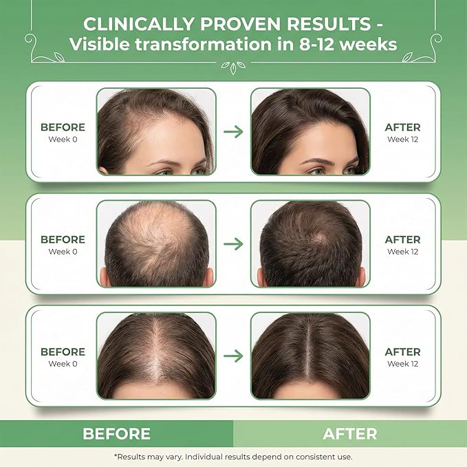 Rosemary and Rice Water Spray for Hair Growth with Biotin & Caffeine - Strengthening Scalp Treatment for Thinning Hair, Dryness & Itch Relief - Vegan & Non-Greasy Hair Spray, 2fl.oz/60ml