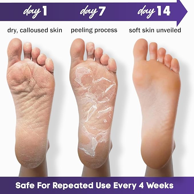 Foot Peeling Mask – Lavender Exfoliating Treatment Booties for Callus Removal & Renewal of Dry, Cracked Feet – Dermatologist-Inspired Moisturizing Spa Therapy for Men & Women (Lavender 4 Pairs)