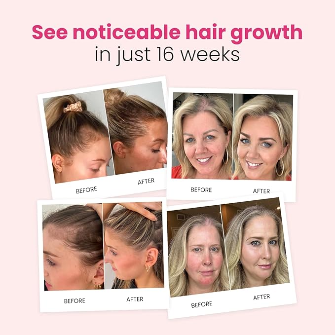 Trybello Hair Growth Shampoo with DHT Blocker | Natural Thickening & Scalp Detox | Sulfate Free & Vegan Formula | Caffeine, Aloe Vera, Turmeric, and Urucum Extract | For Any Hair Type