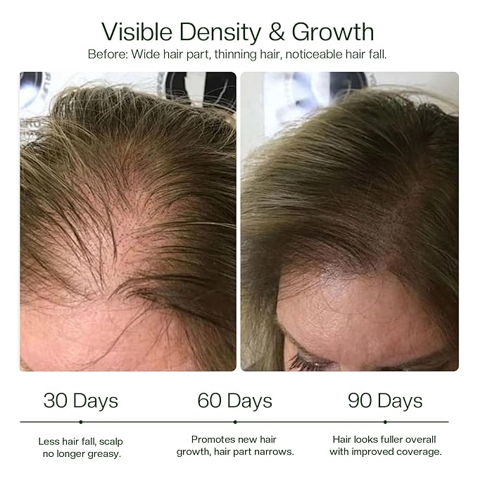 Morovan Hair Growth Spray for Scalp: 30 Days Hair Loss Reduction & Hair Growth with Batana and Castor Oil for Thinning Hair & Damaged Hair & Severe Hair Loss-2.7 fl oz