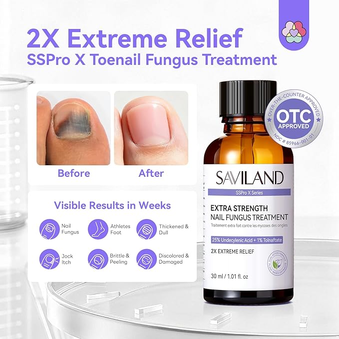 SAVILAND Toenail Fungus Treatment Extra Strength FSA-HSA: 2X Extreme Nail Repair for Discolored and Damaged Nails Toenail Softener Yellow Toenail Foot Toe Thick Nail Fungus Treatments Solution 2 fl oz