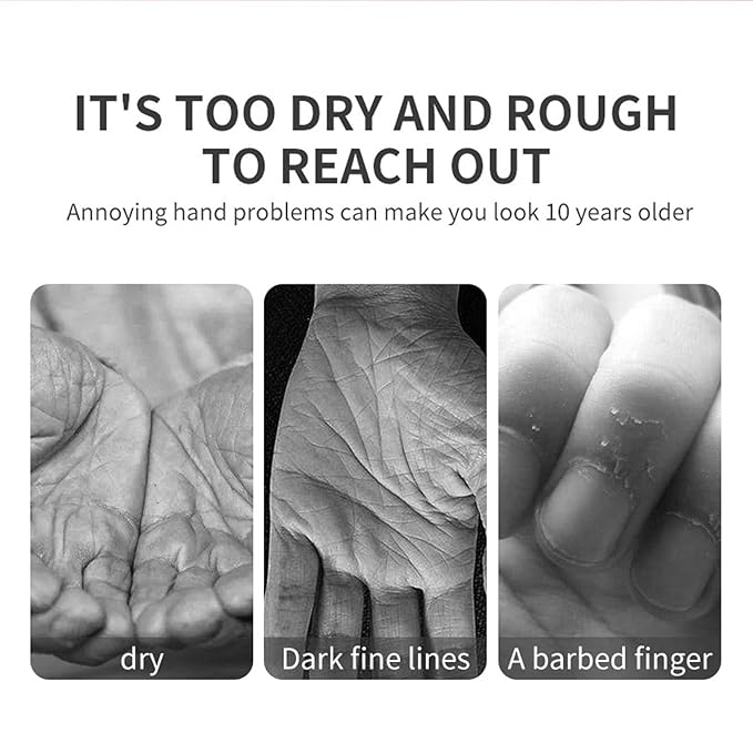 ARCHIDATE Retinol Hand Cream for Aging Hands, Hydrating Hand Cream for Dry Cracked Hands, Smooths Fine Lines & Wrinkles, Soft Smooth Skin, Intense Moisture, Non-Greasy, Fast-Absorbing
