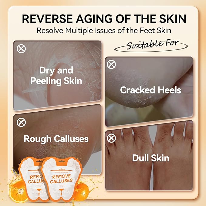 LANBENA Vitamin C Foot Peeling Mask, Foot Mask for Dry Cracked Feet, Exfoliator Peel Off Calluses Dead Skin Callus Remover, Repair Rough Heels & Get a Baby Soft Feet for Men and Women(2 Pairs)