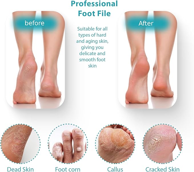 Foot File Pedicure Tool Callus Remover, Durable Foot Scrubber Dead Skin Remover, Professional Toe Cleaning Brush