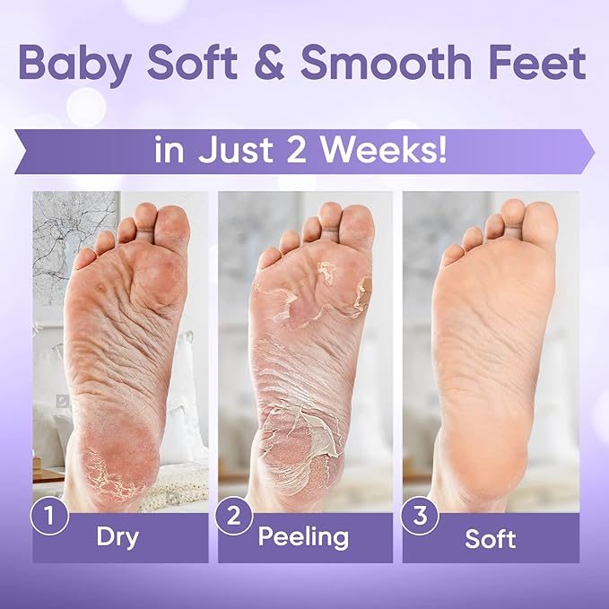 CÉLOR Foot Peeling Mask for Dry Cracked Feet | Foot Mask to Exfoliate Rough, Cracked, Dry Feet, Calluses for Soft Baby Feet Results | Made with Aloe Vera Extract for Women & Men (3 Pairs) | Lavender