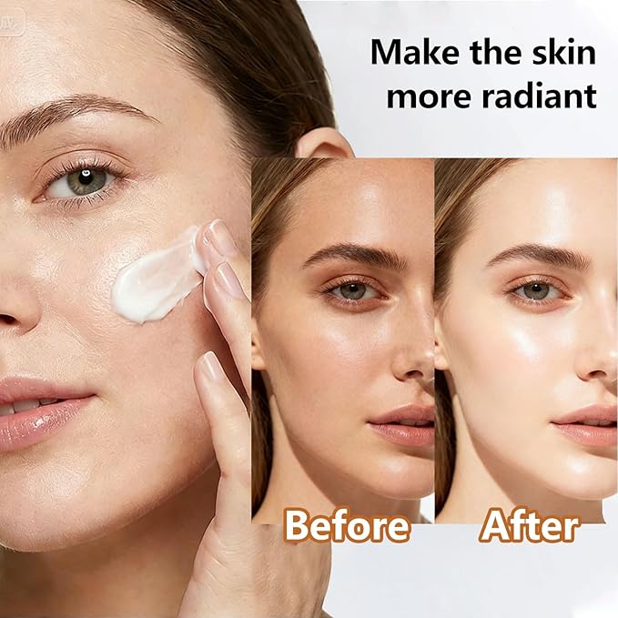 Urea Cream 40% Plus Salicylic Acid 2%, Urea Cream 40 Percent for Feet Maximum Strength, Foot Cream for Dry Heels Cracked