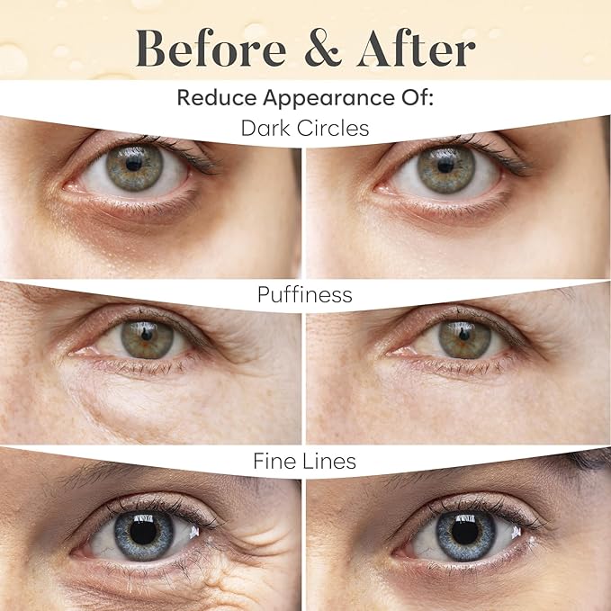 BLOOMORA Daytime Under Eye Patches for Puffy Eyes and Dark Circles, Gel Eye Masks with Caffeine, Collagen & Vitamin C, Deeply Moisturizing, Bachelorette Party Favors, Anti Wrinkle Patches (30 Pairs)