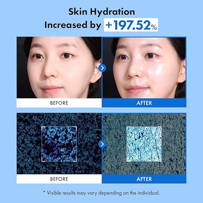 TOSOWOONG 8 Hyaluron Skin Booster Serum for Face with Niacinamide, Glycerin, Panthenol, Hydration Boosting Facial Essence, Plumper Skin, Glass Skin, All Skin Types, Korean Skincare, 150ml/5.07 fl. oz.