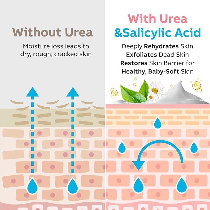 Adellina Urea Cream 40 Percent for Feet Maximum Strength, Urea Foot Cream for Dry Cracked Heels Feet Knees Elbows, 40% Urea Foot Repair Lotion 5.3 OZ