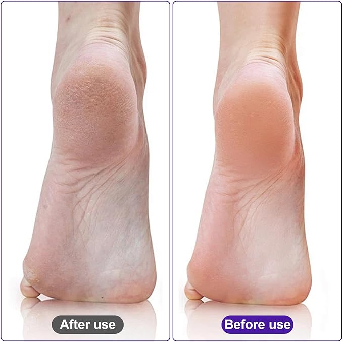 Pumice Stone for Feet 4 Pack Foot Pumice Stone Foot Pumice Stone for Dead Skin Double Sided Pedicure Tools for Feet Pumice Stone for Feet Callus Remover for Feet and Heels