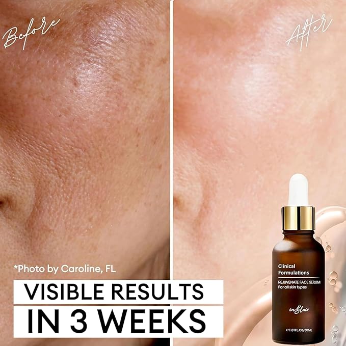 4 Bottle Pack - Inblair Rejuvenate Resurfacing Face Serum - Skin Care Serum for Face Wrinkles, Fine Lines, Dark Spots