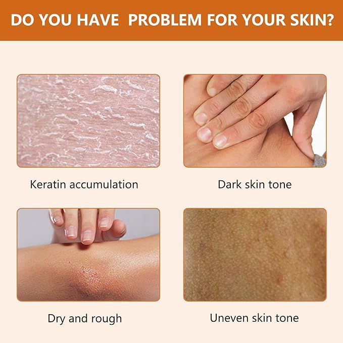 Orange Exfoliating Gel for Face & Body, Orange Exfoliante Scrub Peeling Gel, Exfoliating Cleansing Scrub, Deep Cleansing Moisturizing Facial Exfoliator, Remove Blackheads for All Types Skin (2pcs, 1)