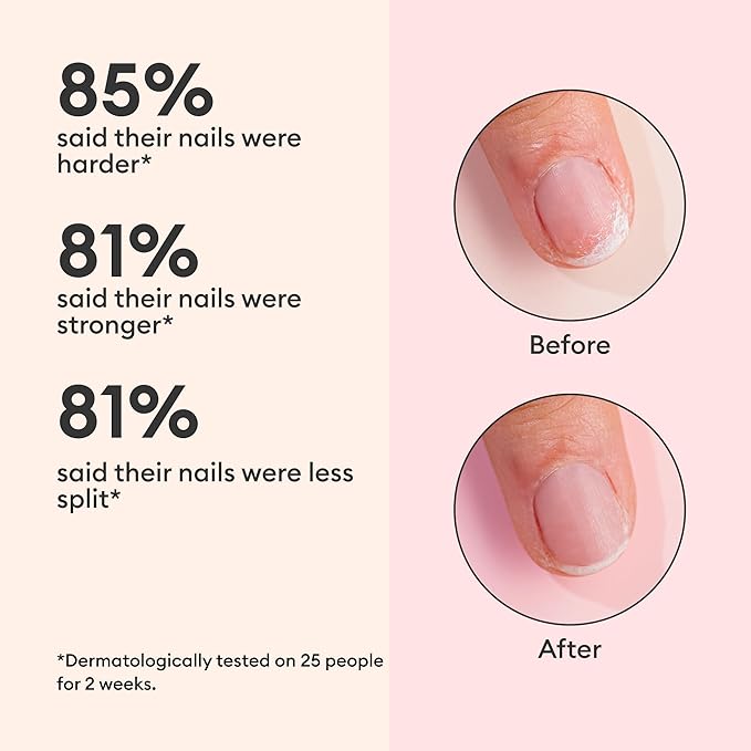 Manucurist - Keratin Clear Nail Care Serum – Nail Strengthener for Damaged Nails, Lightweight Fast-Absorbing Formula, Glossy Finish, Plant-Based Keratin, Biotin & Vitamin C, Nail Hardener Effect