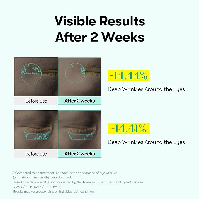 VT COSMETICS PDRN Reedle Shot Firming Eye Cream (0.51 fl oz / 15ml), Ultra-Micro Vibration Eye Cream for Firming & Elasticity, Targeted Wrinkle Care, PDRN Collagen, Korean Skincare