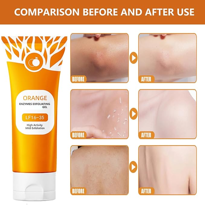 Orange Exfoliating Gel for Face & Body, Orange Exfoliante Scrub Peeling Gel, Exfoliating Cleansing Scrub, Deep Cleansing Moisturizing Facial Exfoliator, Remove Blackheads for All Types Skin (3pcs, 1)