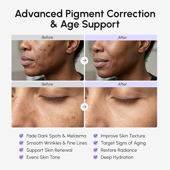 MAREE Tranexamic Acid Face Cream - Cream with Alpha Arbutin, Niacinamide, Peptide Complex & Vitamin C - Crema para las Manchas de la Cara