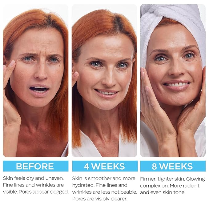 Retinol Cream for Face 2-Pack – Anti-Aging Moisturizer with Hyaluronic Acid & Collagen, Day & Night Face Cream for Wrinkles & Fine Lines, 3.7 Oz (Pack of 2)