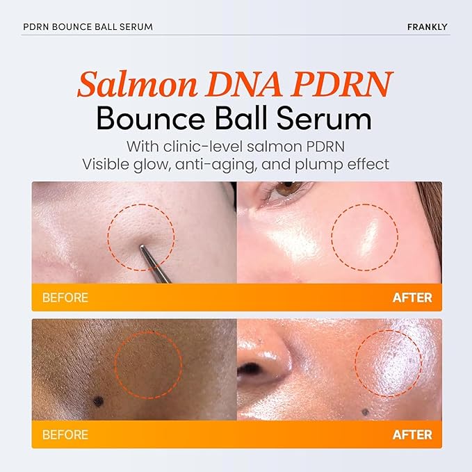 FRANKLY Salmon PDRN Bounce Ball Serum – 99% Pure Salmon DNA PDRN for Post Microneedling Recovery, Redness & Damaged Skin Repair | Glass Skin Korean Skincare | Lightweight, Non Sticky | 1.01 fl oz