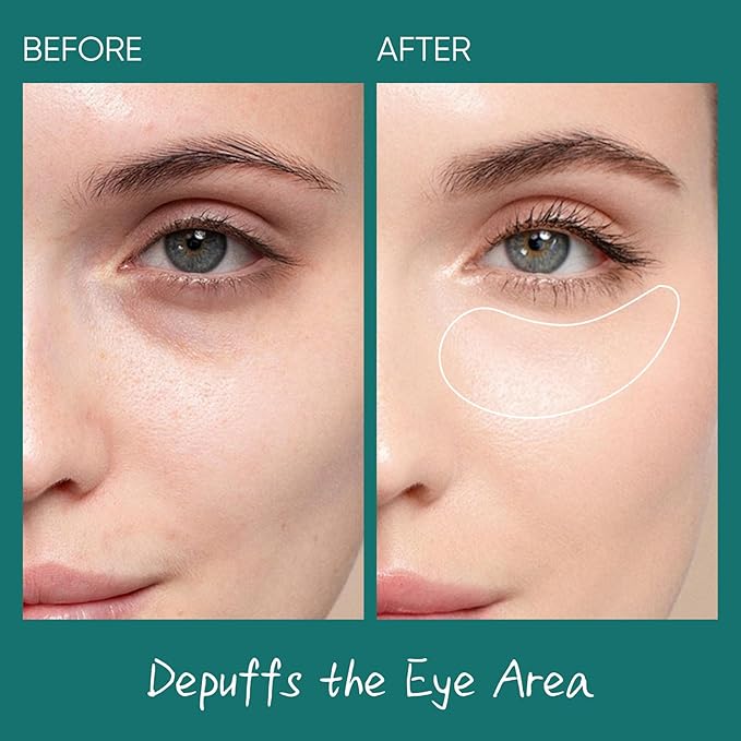 Salmon DNA PDRN Eye Cream for Puffiness and Bags Under Eyes - with Caffeine & Hyaluronic Acid, Niacinamide for Dark Circle & Hydration