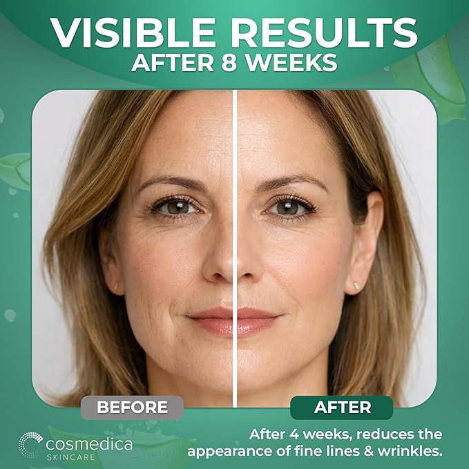 Cosmedica Skincare Retinol Serum 2.5% for Face | Anti-Aging Vitamin A Serum with Hyaluronic Acid, Green Tea & Vitamin E | Reduces Wrinkles, Acne Scars & Dark Spots | Gentle for Sensitive Skin | 1 oz