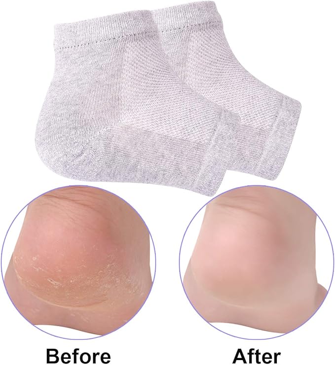 Vented Moisturizing Gel Heel Socks, 3 Pairs Toeless Spa Sock for Foot Care Treatment, Cracked Heels, Dry Feet, Foot Calluses (Grey)