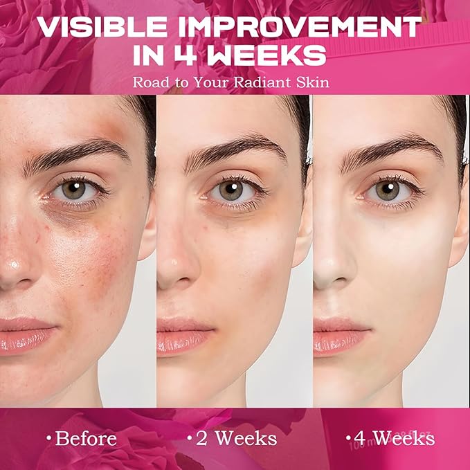 PDRN Collagen Wrapping Mask, Overnight Peel Off Face Mask, Salmon DNA, Niacinamide, Peptides, Centella for Skin Firming, Tone Evening & Dark Spot, Repairing, Soothing, 100ml/3.38 fl.oz.