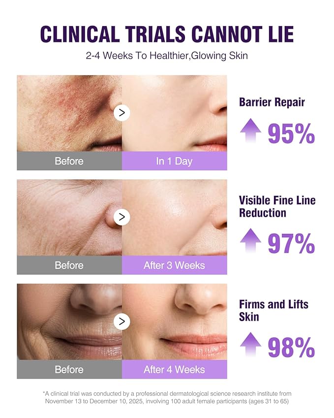 Retinol Peptides Serum for Face: Anti Aging Collagen NAD+ Hydration Serum for Wrinkles Fine Lines, Firming Face Neck Skin for Women Men Day Night