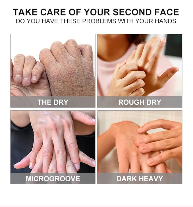 VolksRose 5 Pairs Hand Mask Gloves with Rose & Milk - Moisturizing Hand Mask for Dry Cracked Hands Overnight Repair Treatment, Intensive Hydration Spa Gloves for Women, Self Care Gifts for Rough Skin